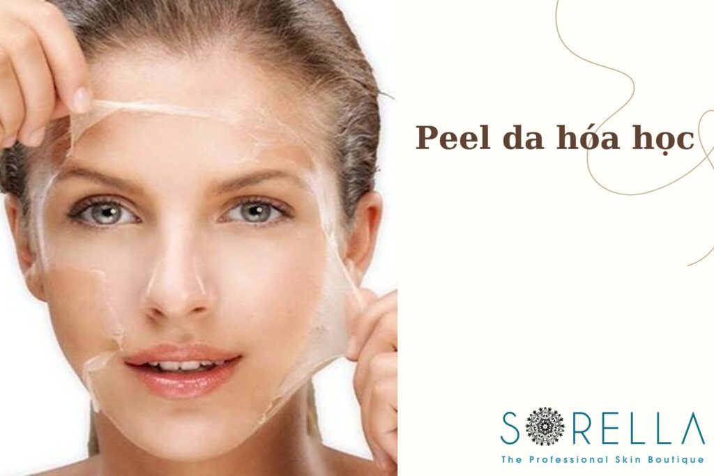 những điều cần biết về peel da hoá học