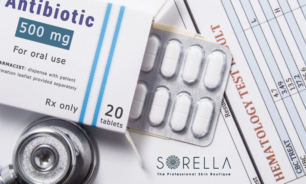 Oral antibiotics may be required to decrease bacteria in moderate to severe acne