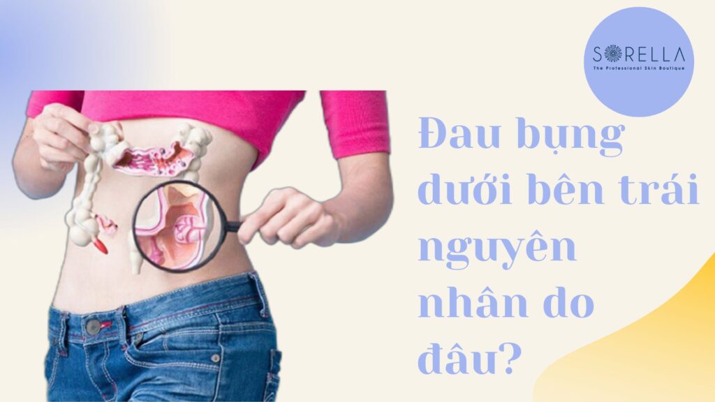 Đau bụng dưới bên trái nguyên nhân do đâu?