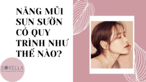 Nâng mũi sụn sườn có quy trình như thế nào?