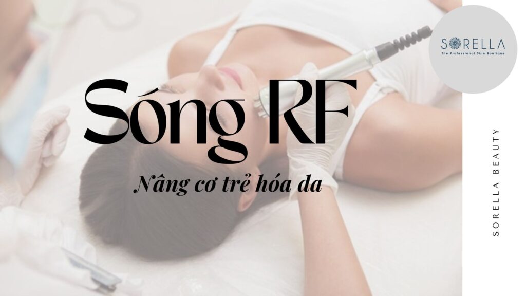 Sóng RF là gì?