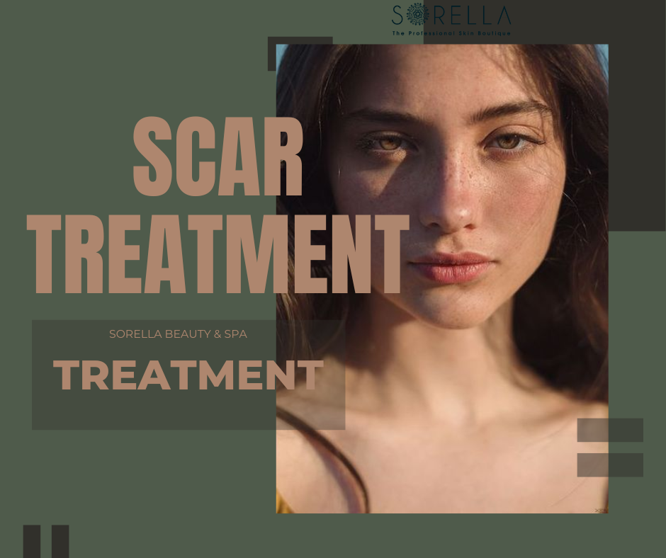 Scar treatments will change depending on the type of scar
