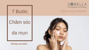 chăm sóc da mụn