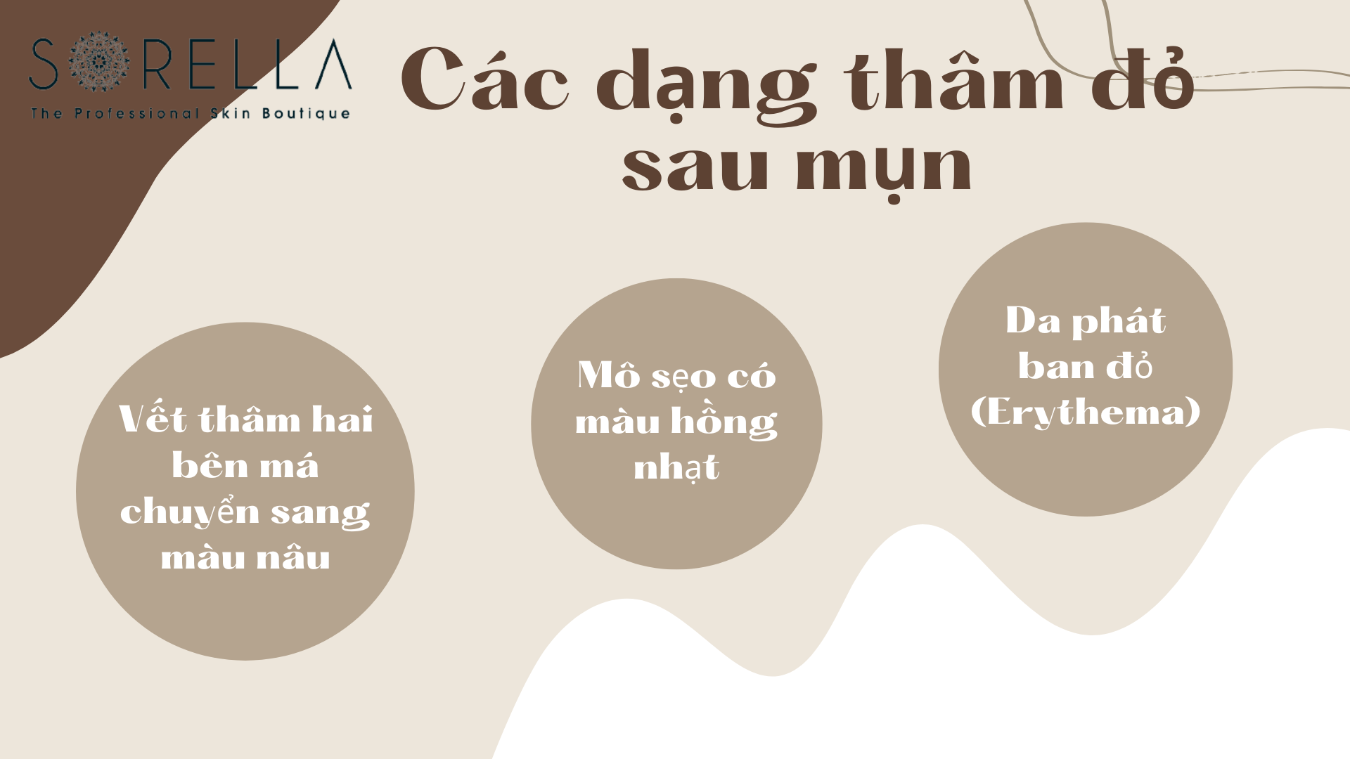 Các dạng thâm đỏ sau mụn