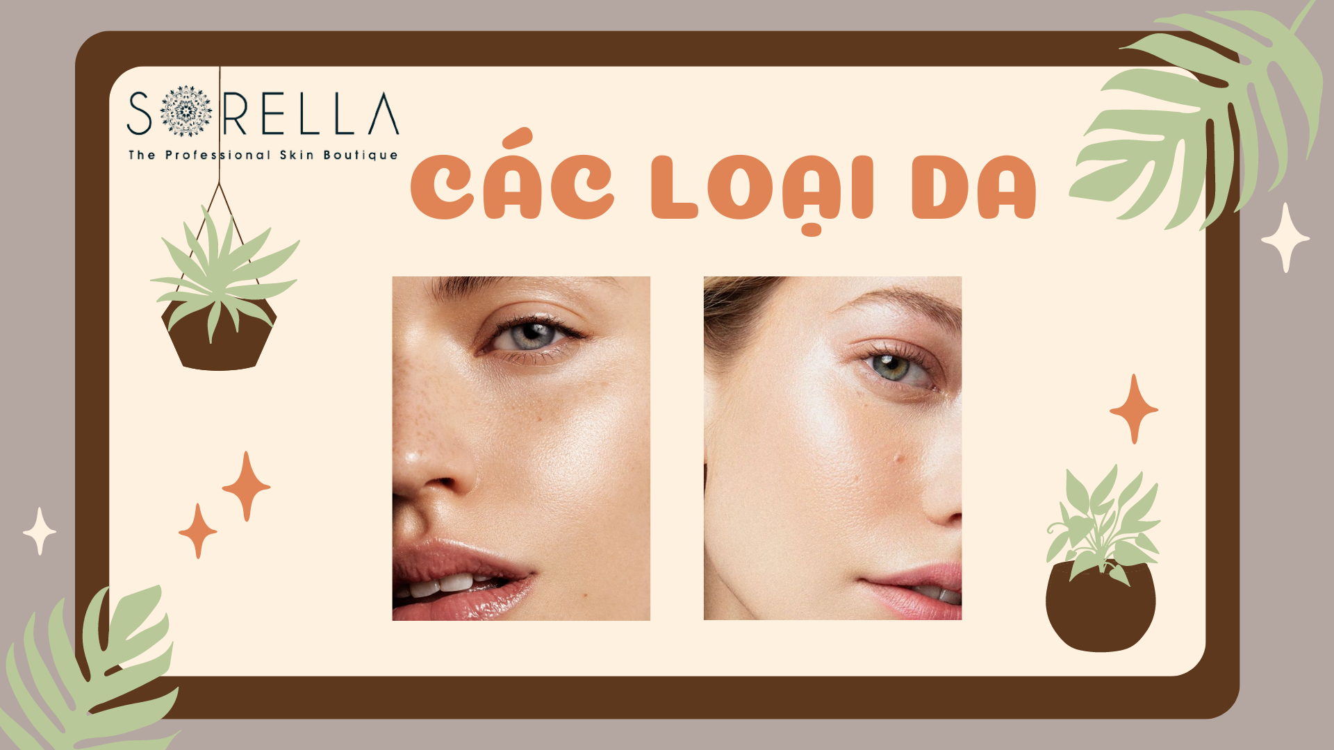 Các loại da cơ bản