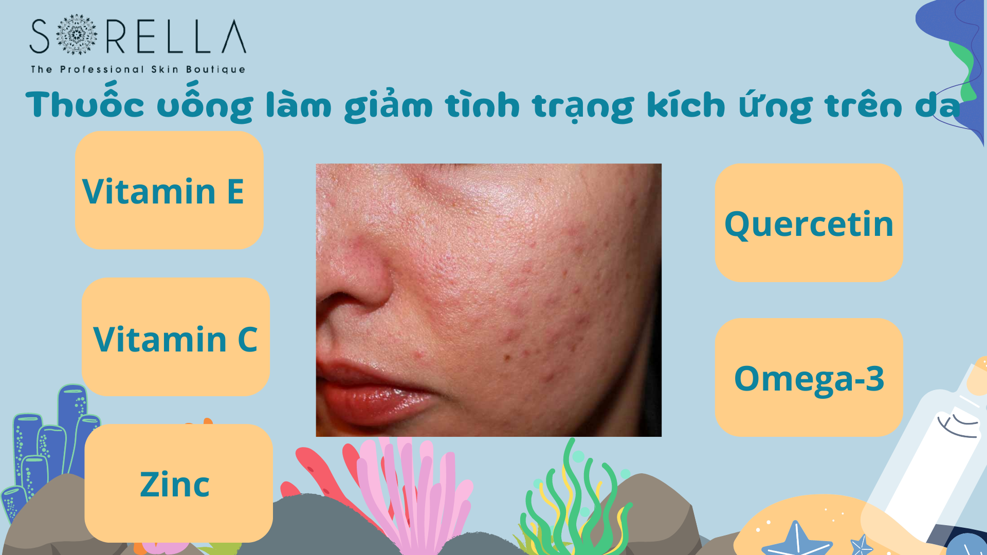 Một số thuốc uống làm giảm tình trạng kích ứng trên da