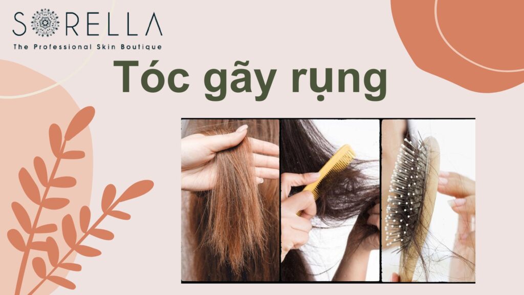 Tóc gãy rụng