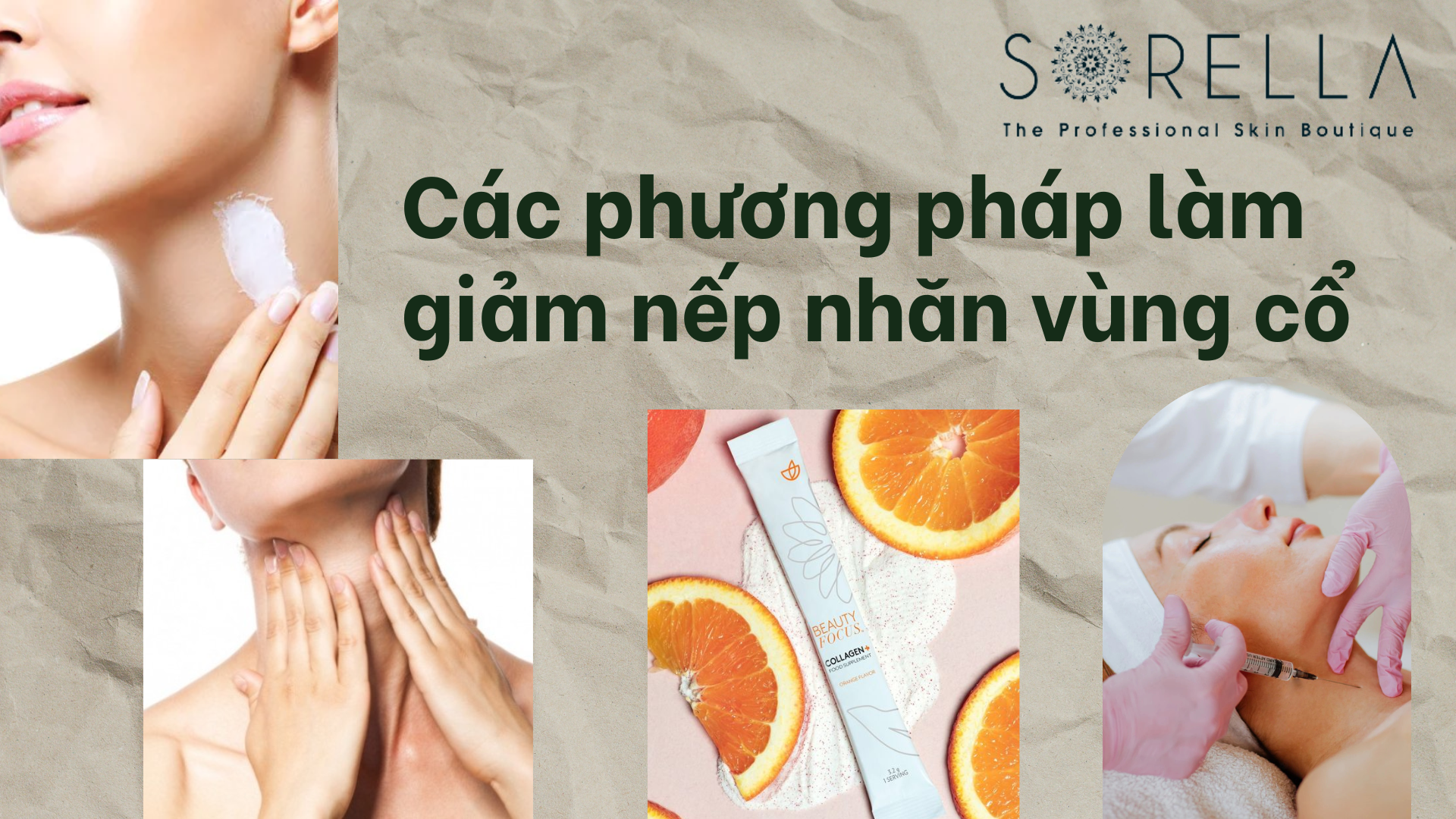 Các phương pháp làm giảm nếp nhăn vùng cổ