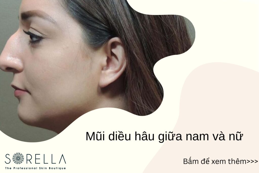 Mũi diều hâu
