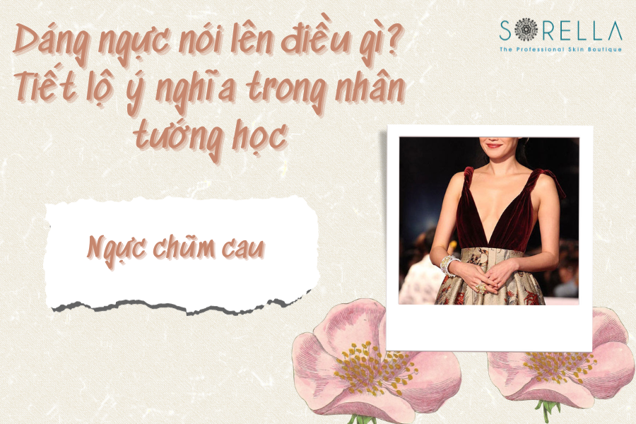 Dáng ngực chũm cau ở phụ nữ