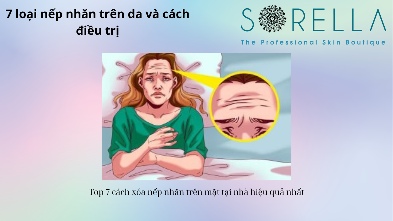 7 loại nếp nhăn trên da và cách điều trị 