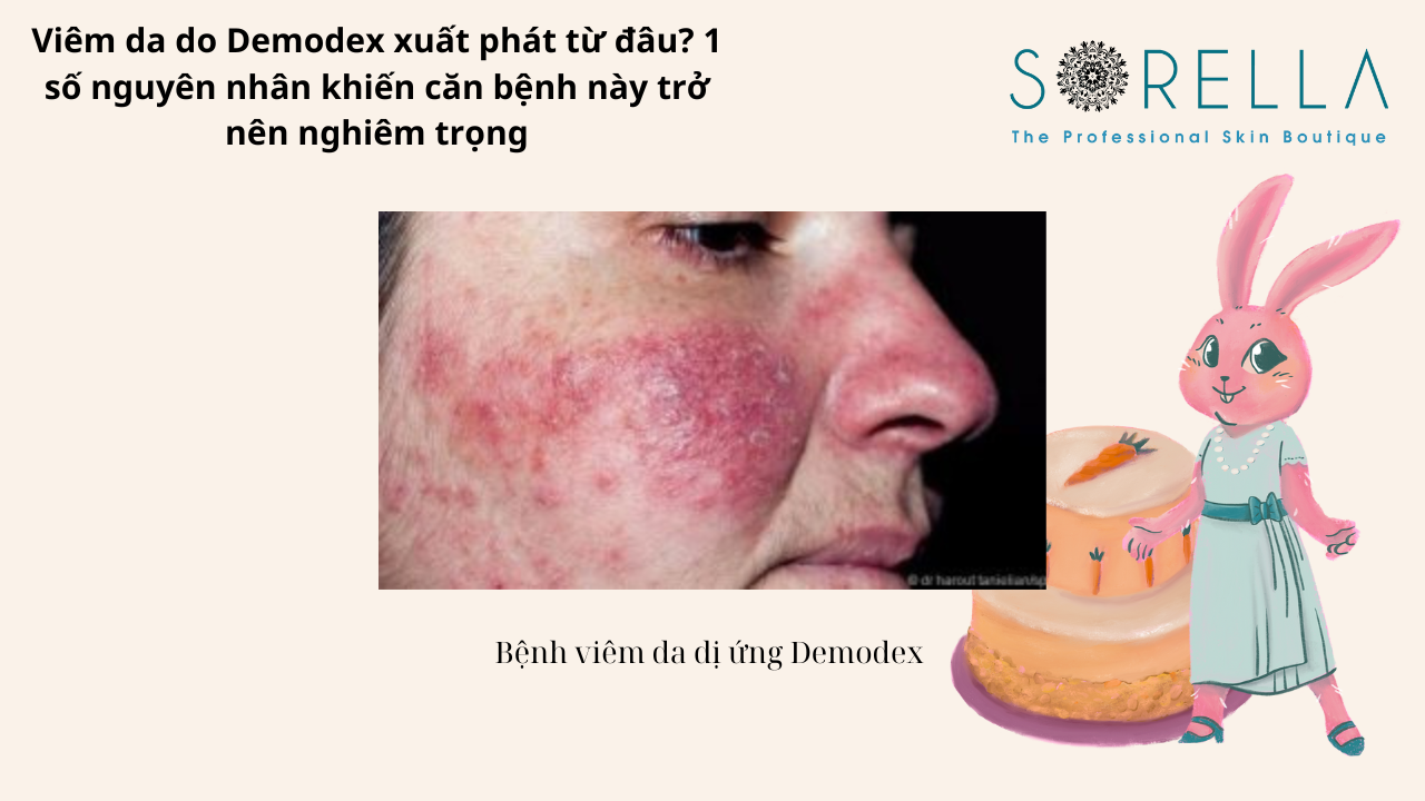 Viêm da do Demodex xuất phát từ đâu?