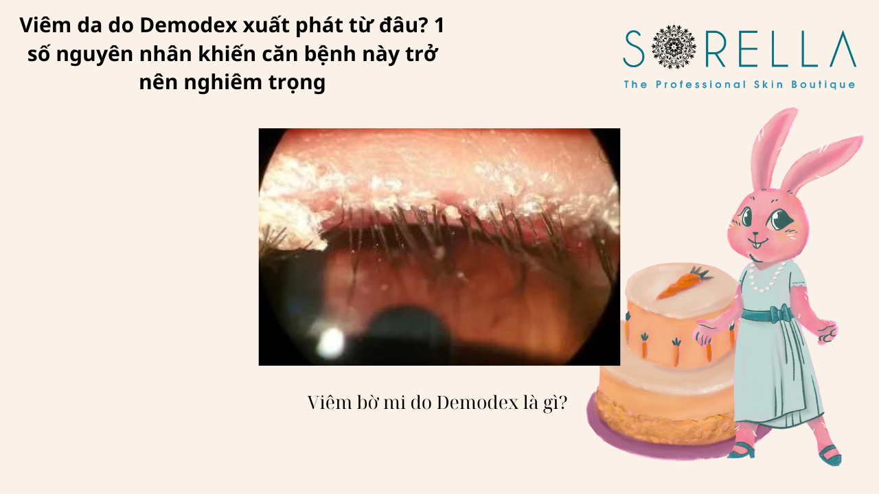 Viêm da do Demodex xuất phát từ đâu?