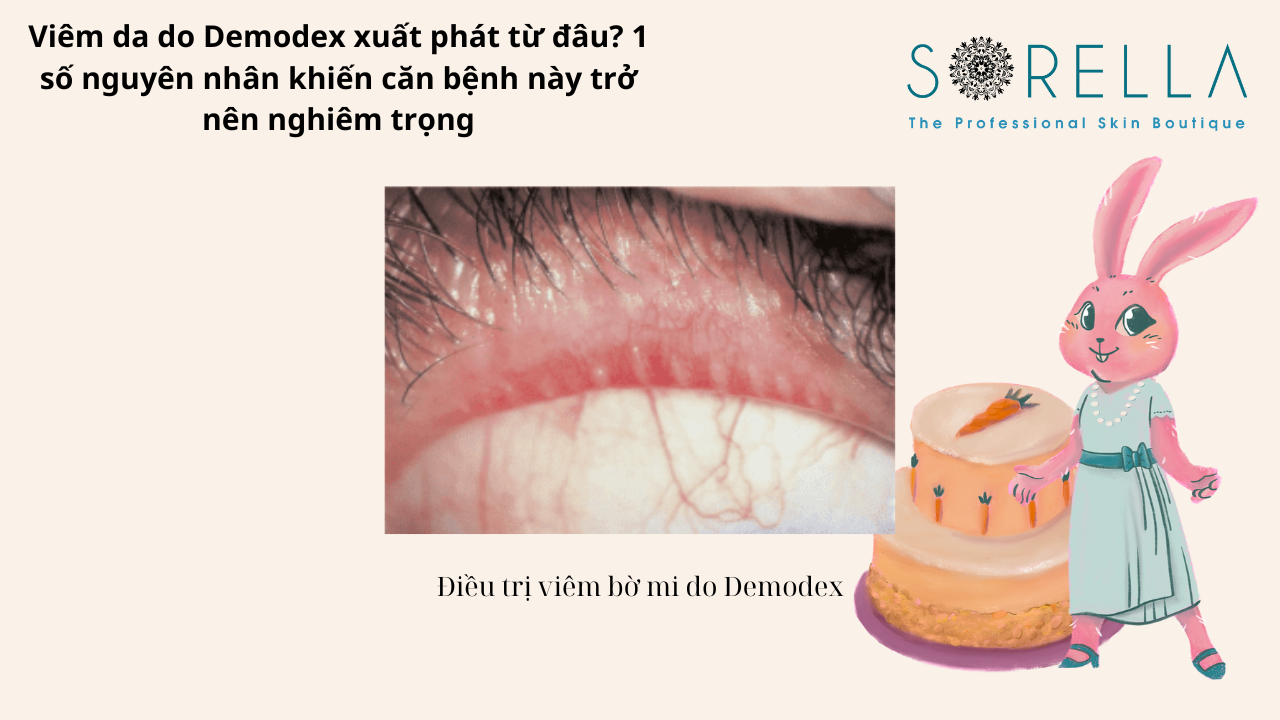 Viêm da do Demodex xuất phát từ đâu?