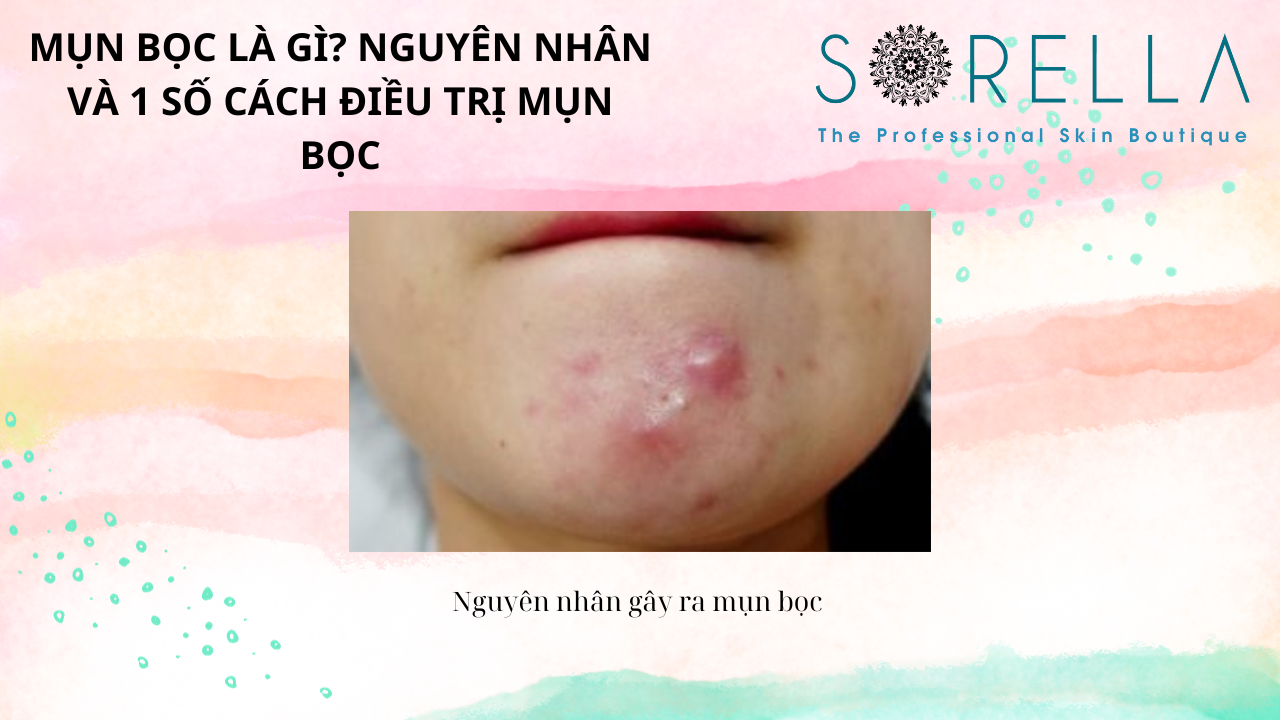 Mụn bọc là gì?