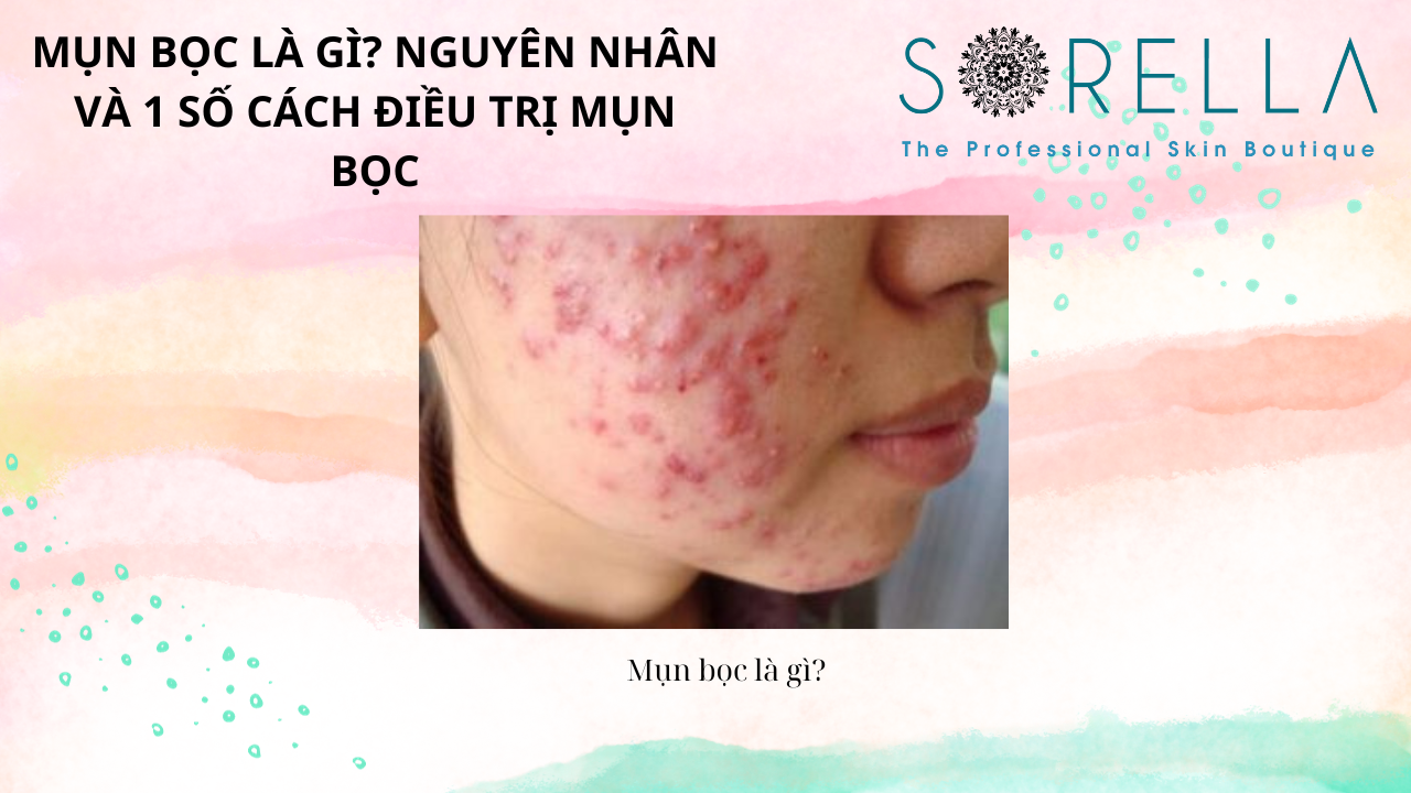 Mụn bọc là gì?