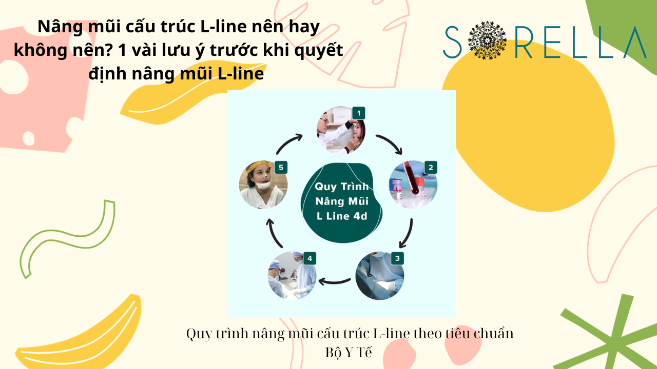 Nâng mũi cấu trúc L-line 