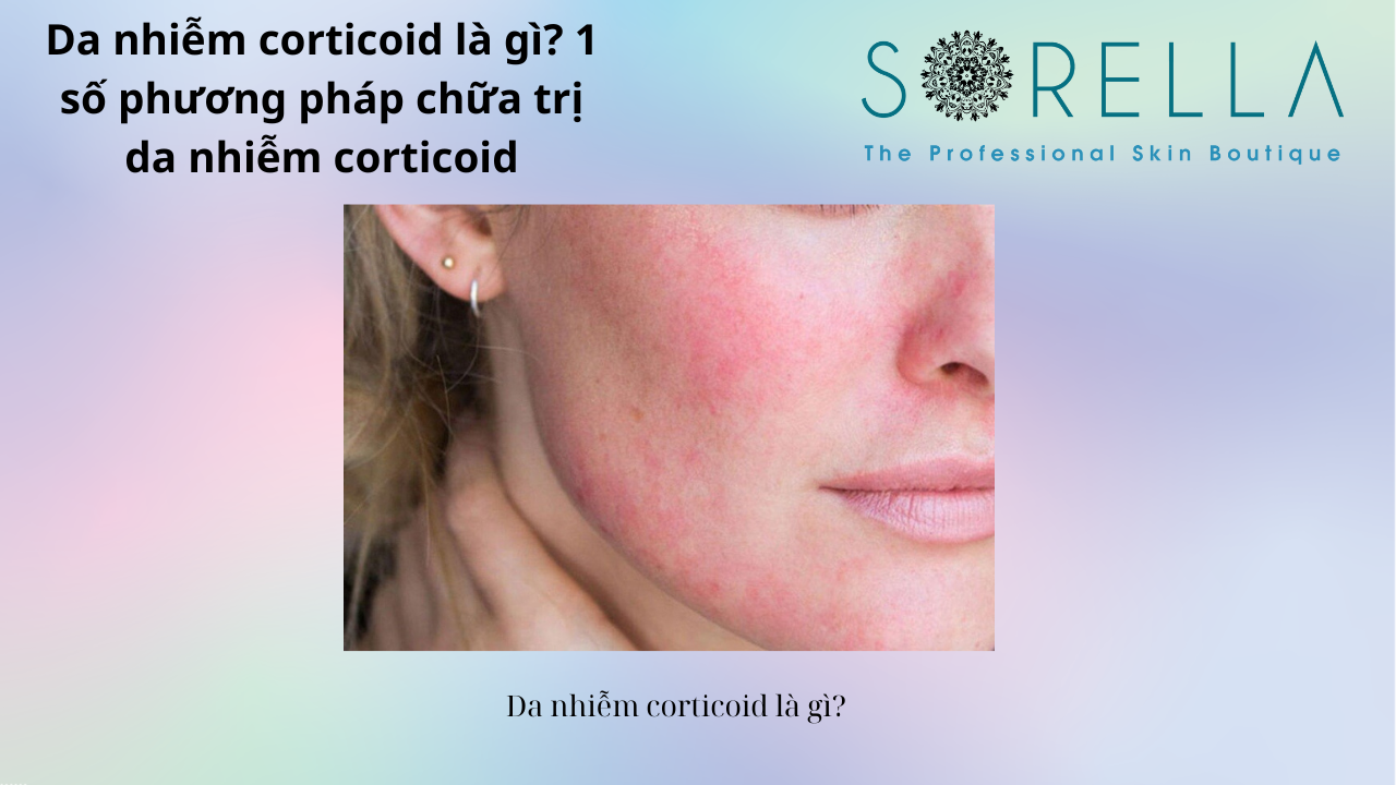 Da nhiễm corticoid là gì? 