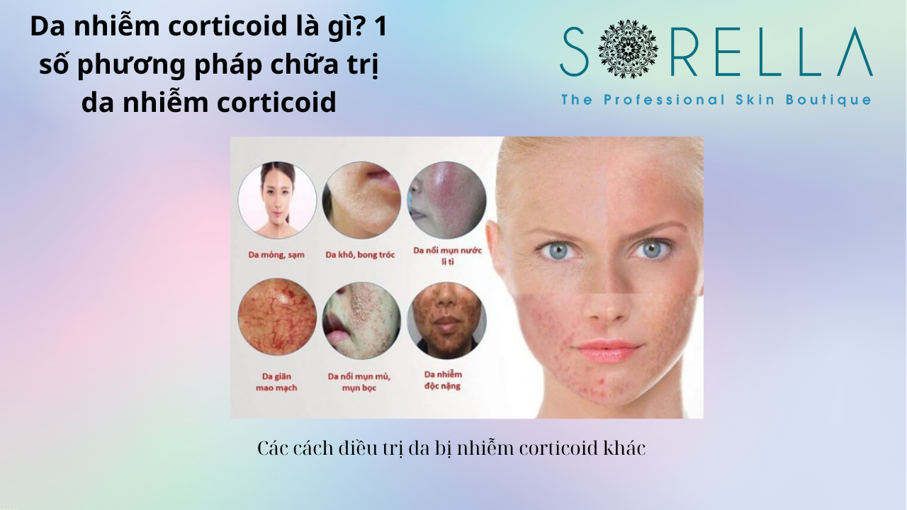 Da nhiễm corticoid là gì? 