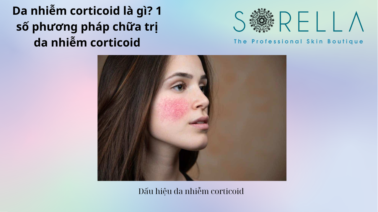 Da nhiễm corticoid là gì?