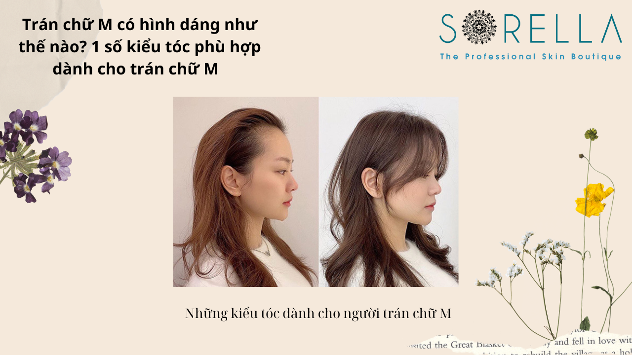 Trán chữ M có hình dáng như thế nào? 