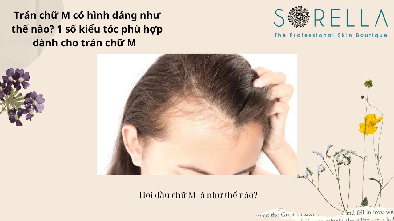 Trán chữ M có hình dáng như thế nào? 