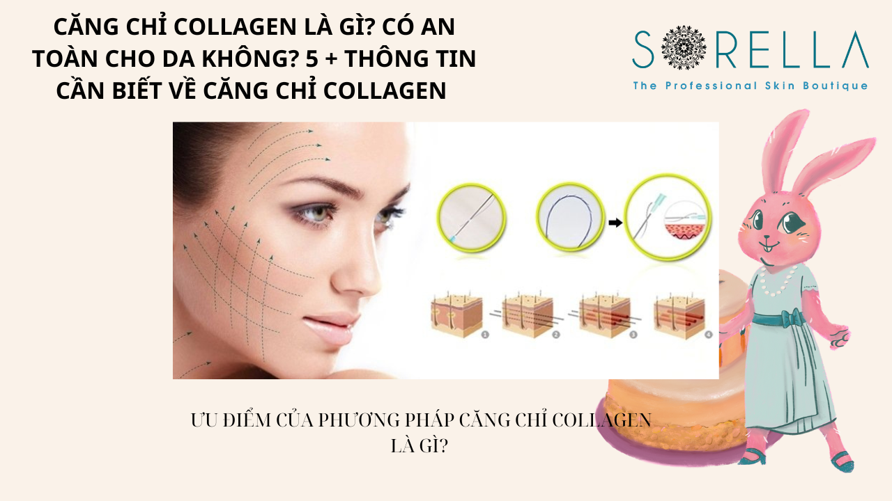 Căng chỉ collagen là gì?