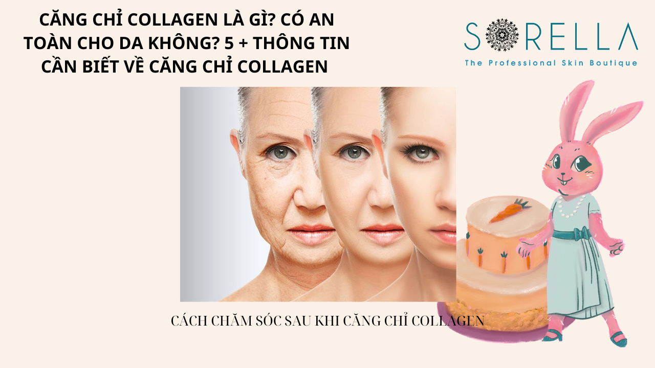 Căng chỉ collagen là gì?