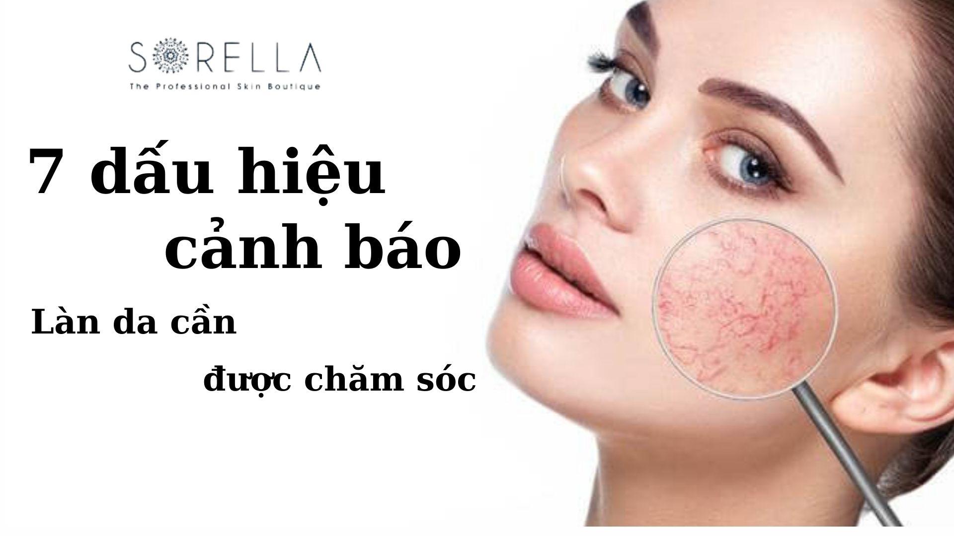 7 dấu hiệu cảnh báo làn da cần chăm sóc