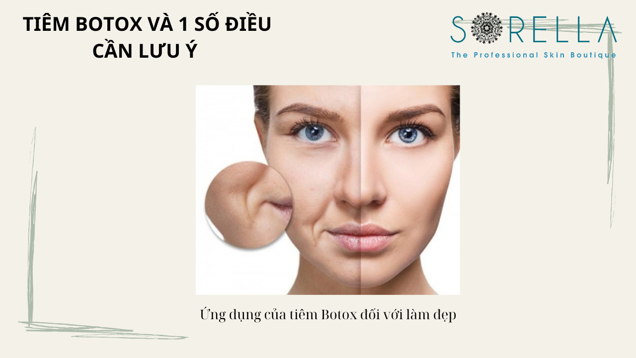 Tiêm botox và 1 số điều cần lưu ý 