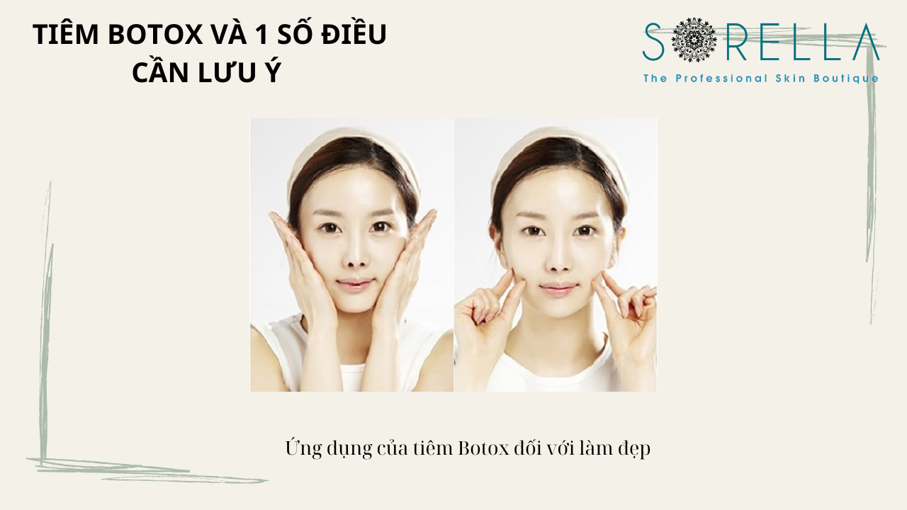 Tiêm botox và 1 số điều cần lưu ý 