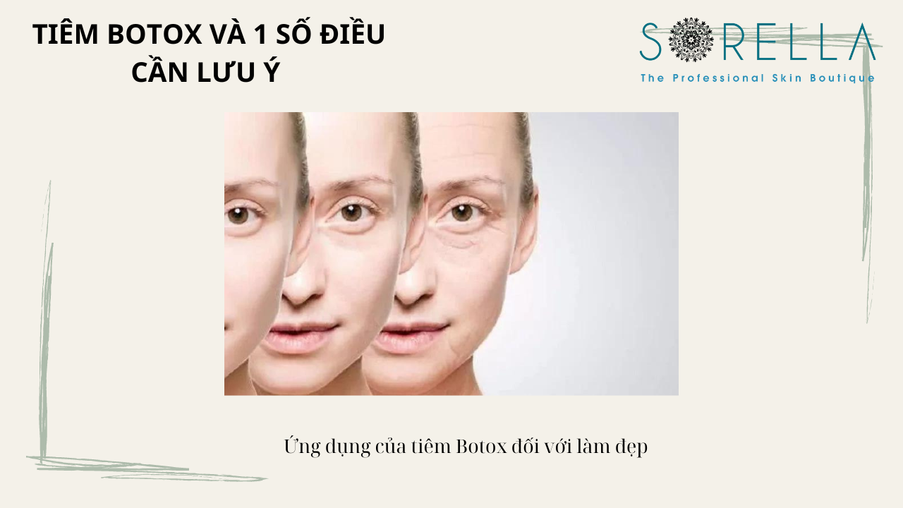 Tiêm botox và 1 số điều cần lưu ý 