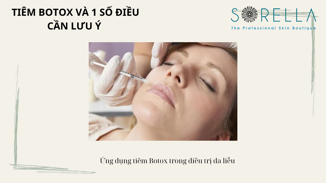 Tiêm botox và 1 số điều cần lưu ý 