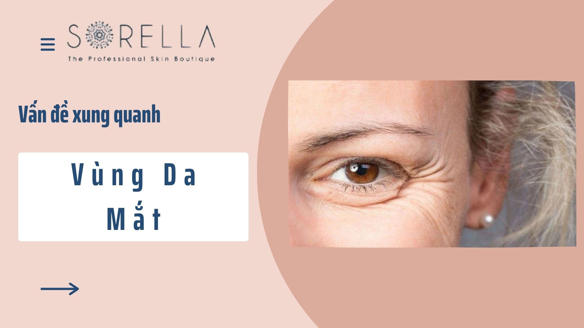5 lý do bạn cần chăm sóc riêng vùng da quanh mắt