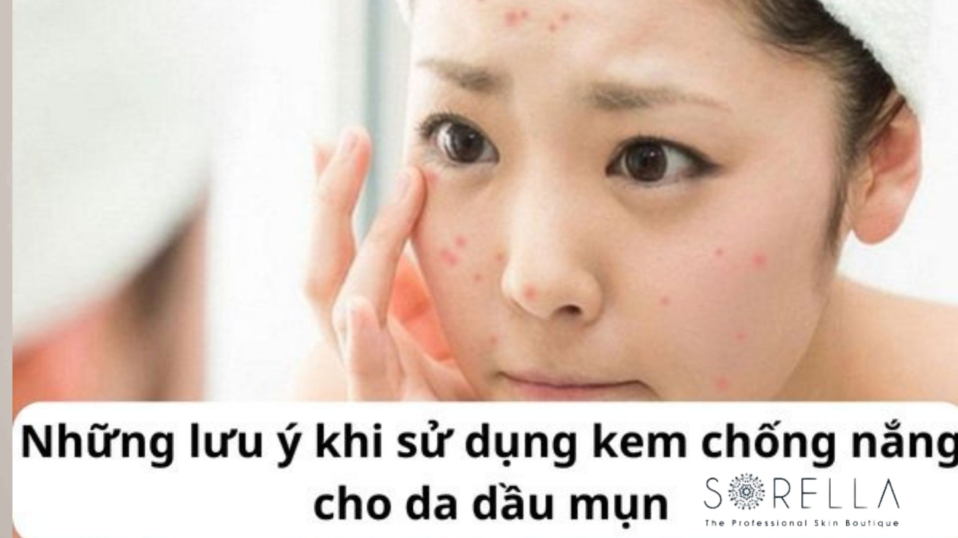 7 Bước skincare cho da mụn tuổi dậy thì