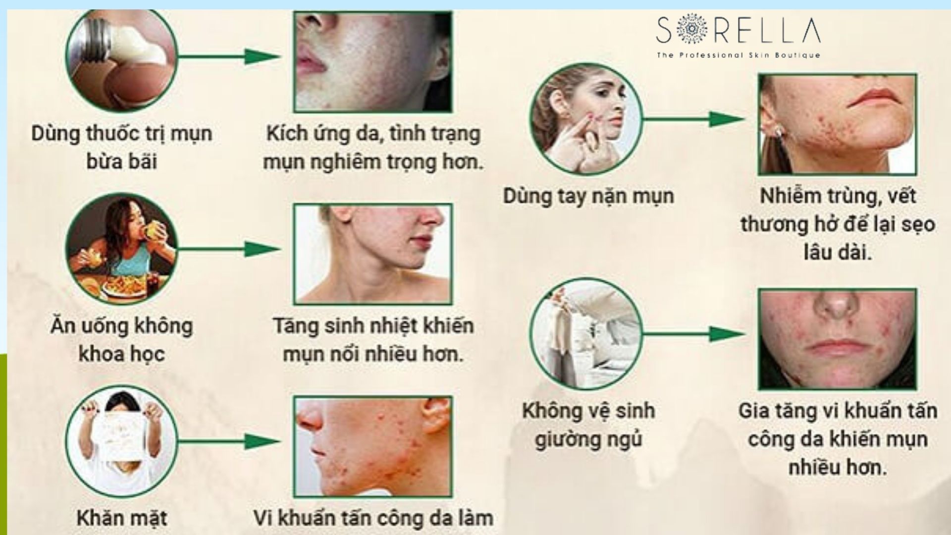 8 Nguyên nhân gây mụn và cách điều trị