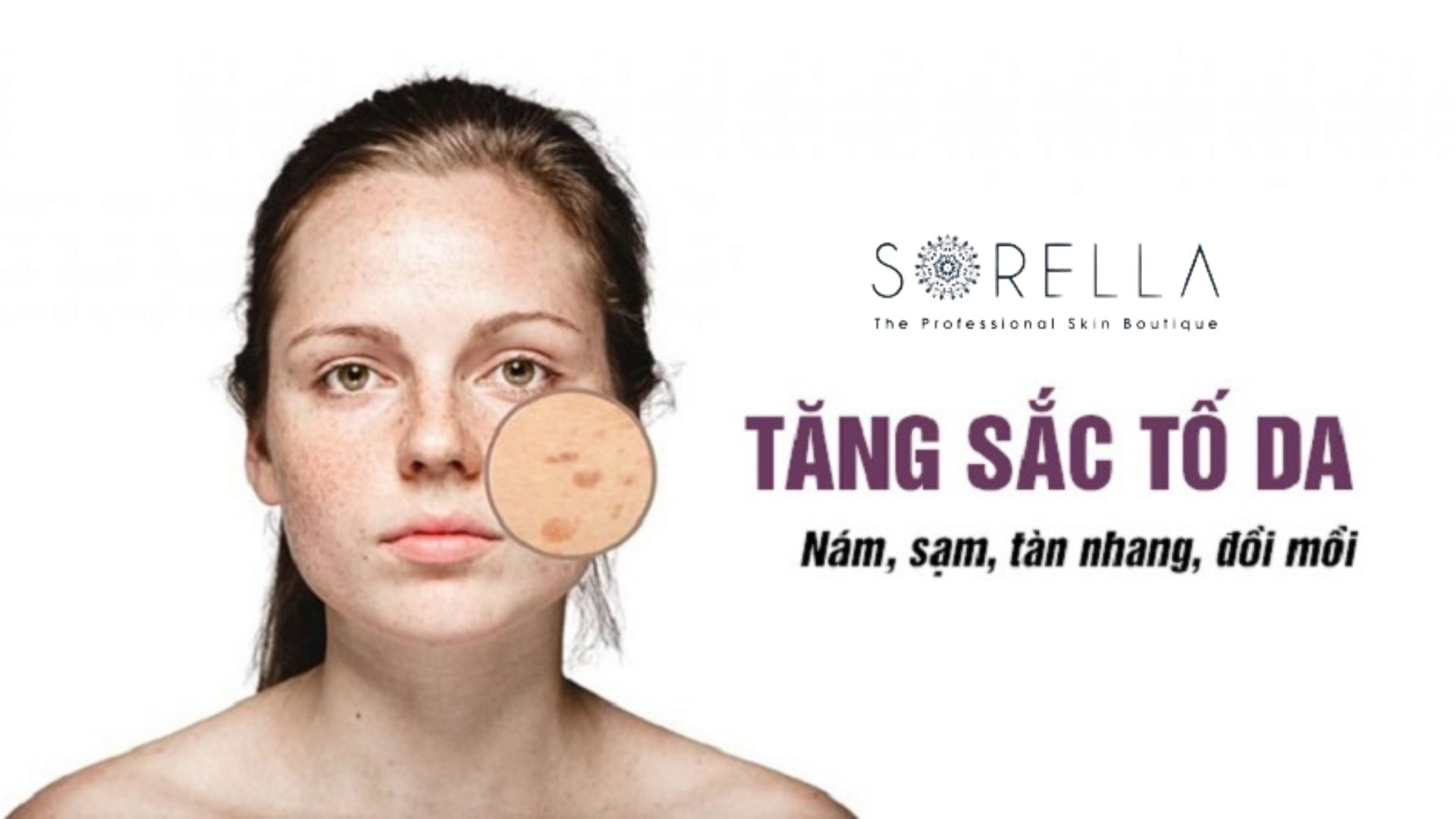 8 Nguyên nhân làm tăng sắc tố da