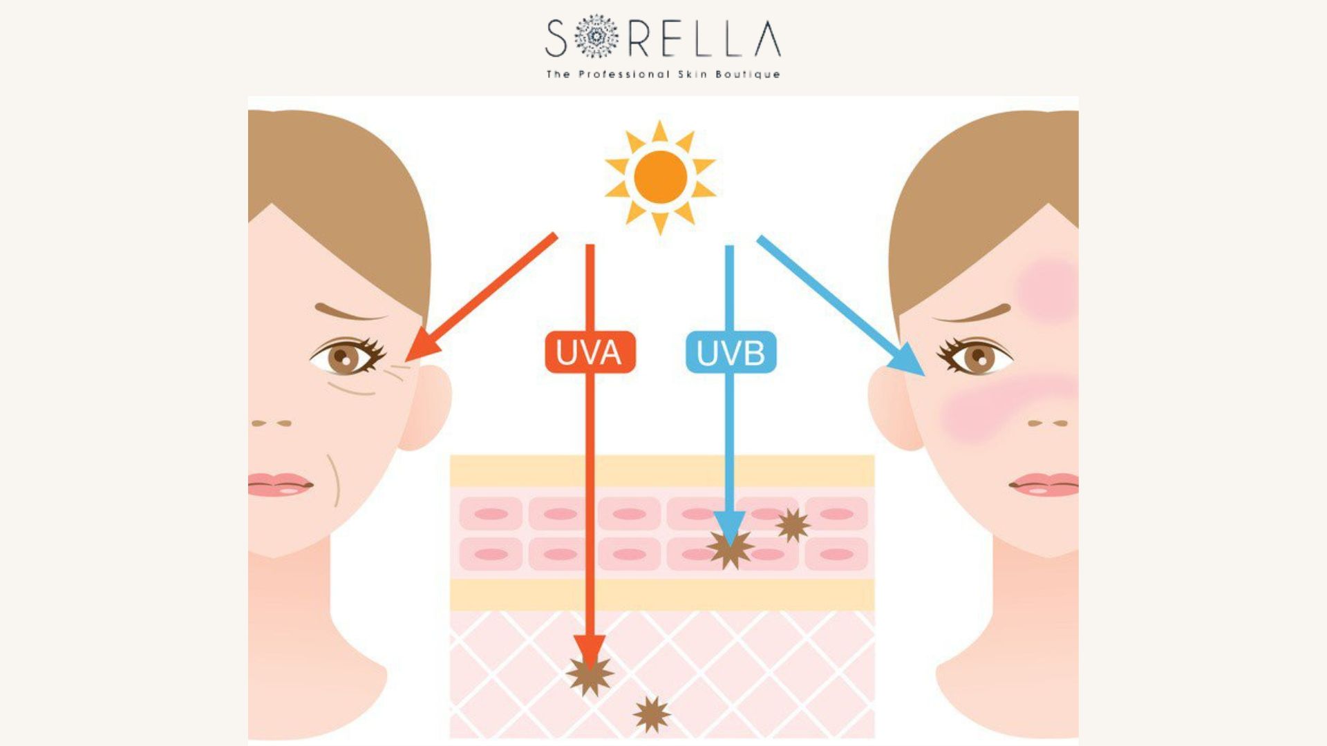 5 Cách bảo vệ da khỏi tia UV hiệu quả
