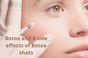 Botox and 8 side effects of botox shots