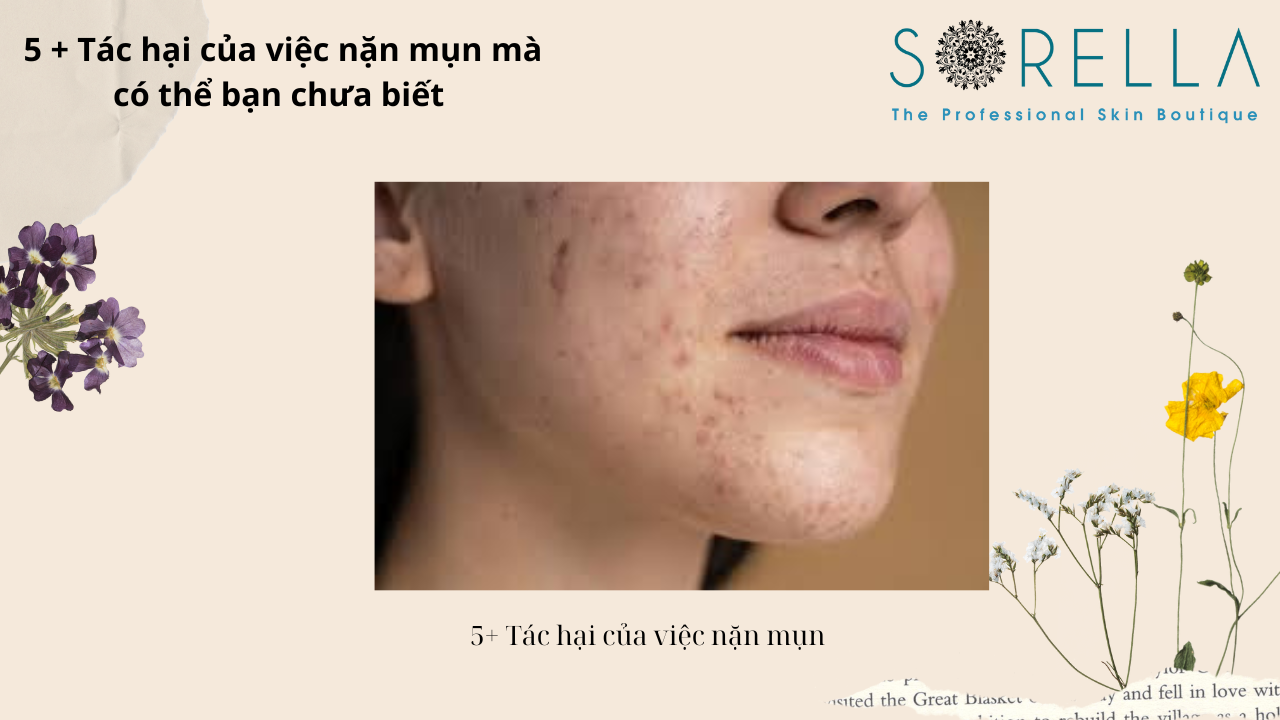 5+ Tác hại của việc nặn mụn