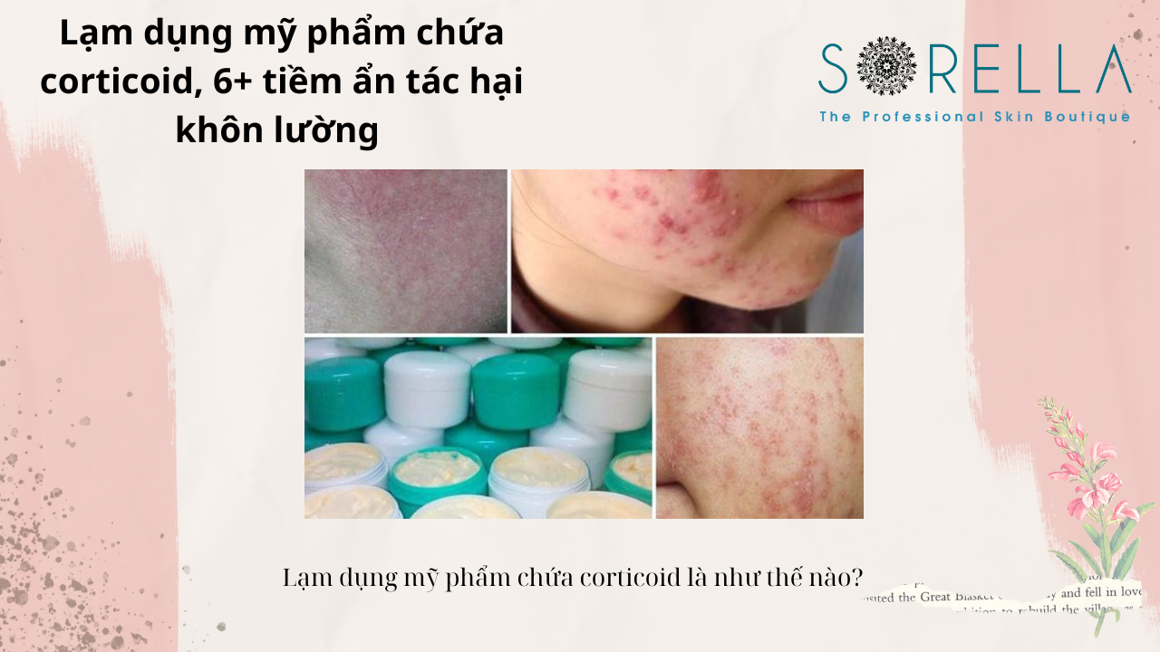 Lạm dụng mỹ phẩm chứa corticoid 