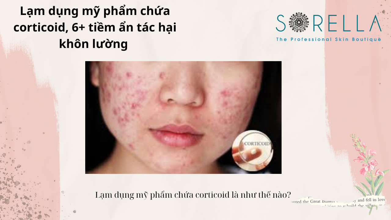 Lạm dụng mỹ phẩm chứa corticoid 