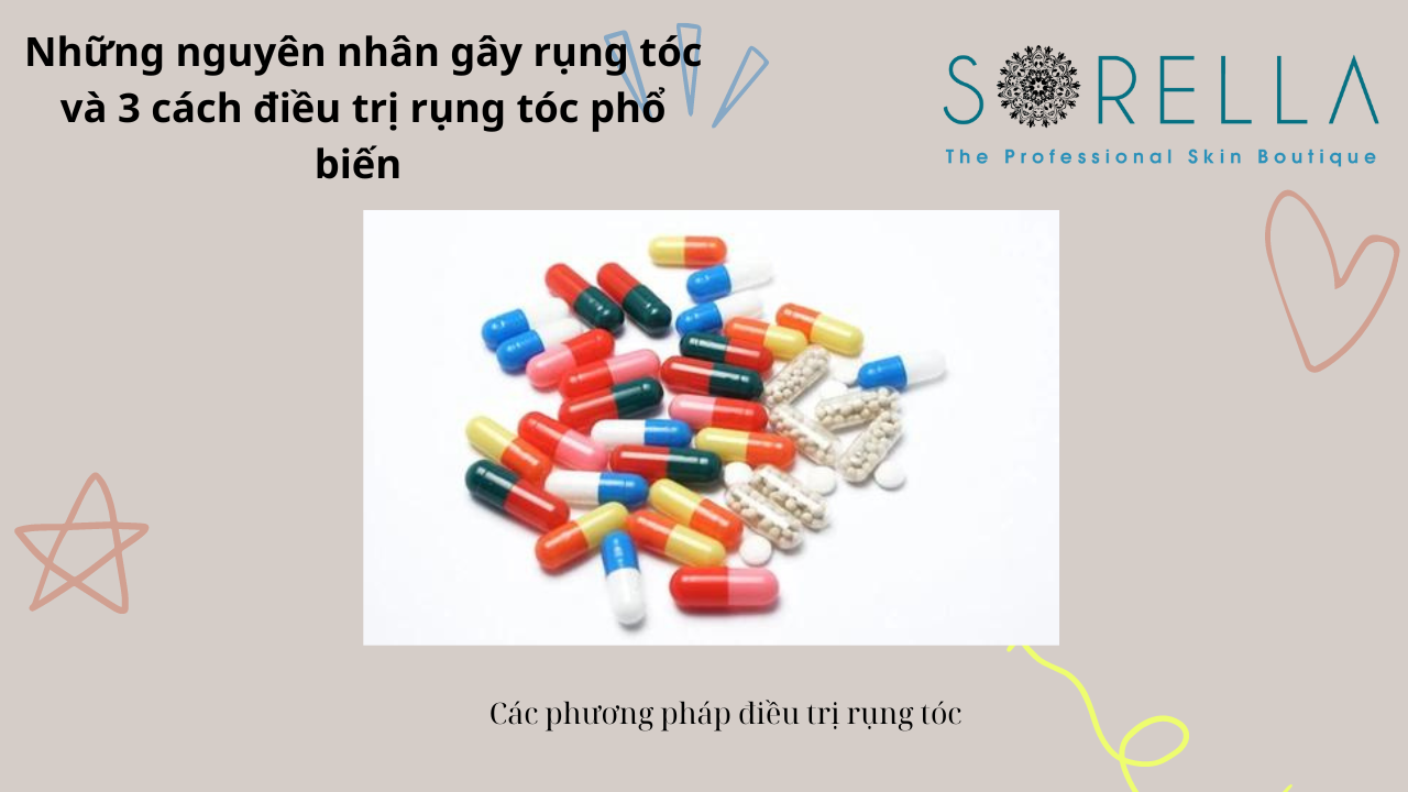 Rụng tóc là như thế nào? 