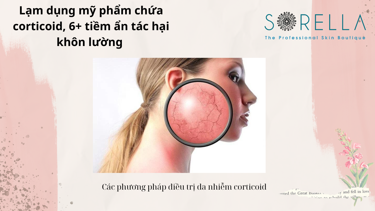 Lạm dụng mỹ phẩm chứa corticoid 