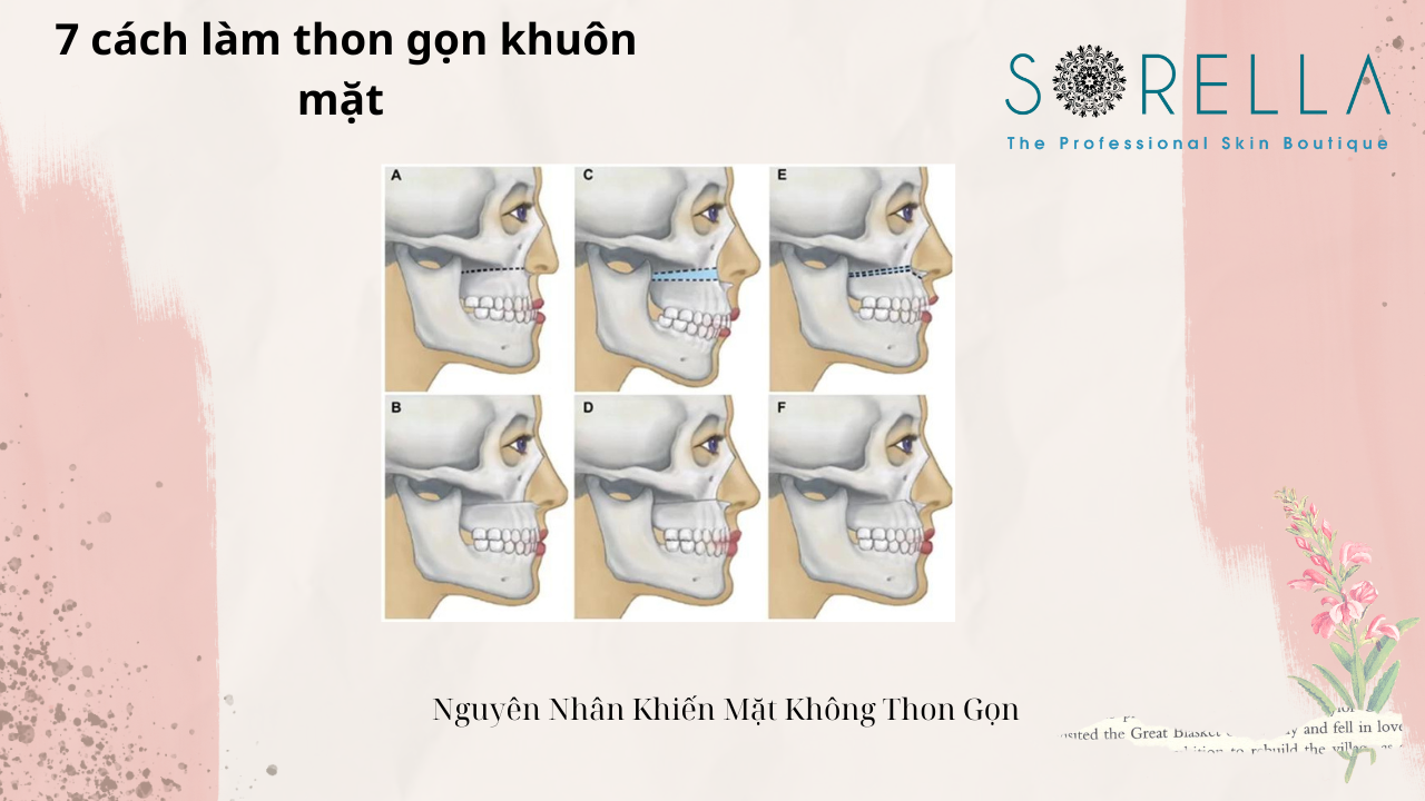 Cách làm thon gọn khuôn mặt 