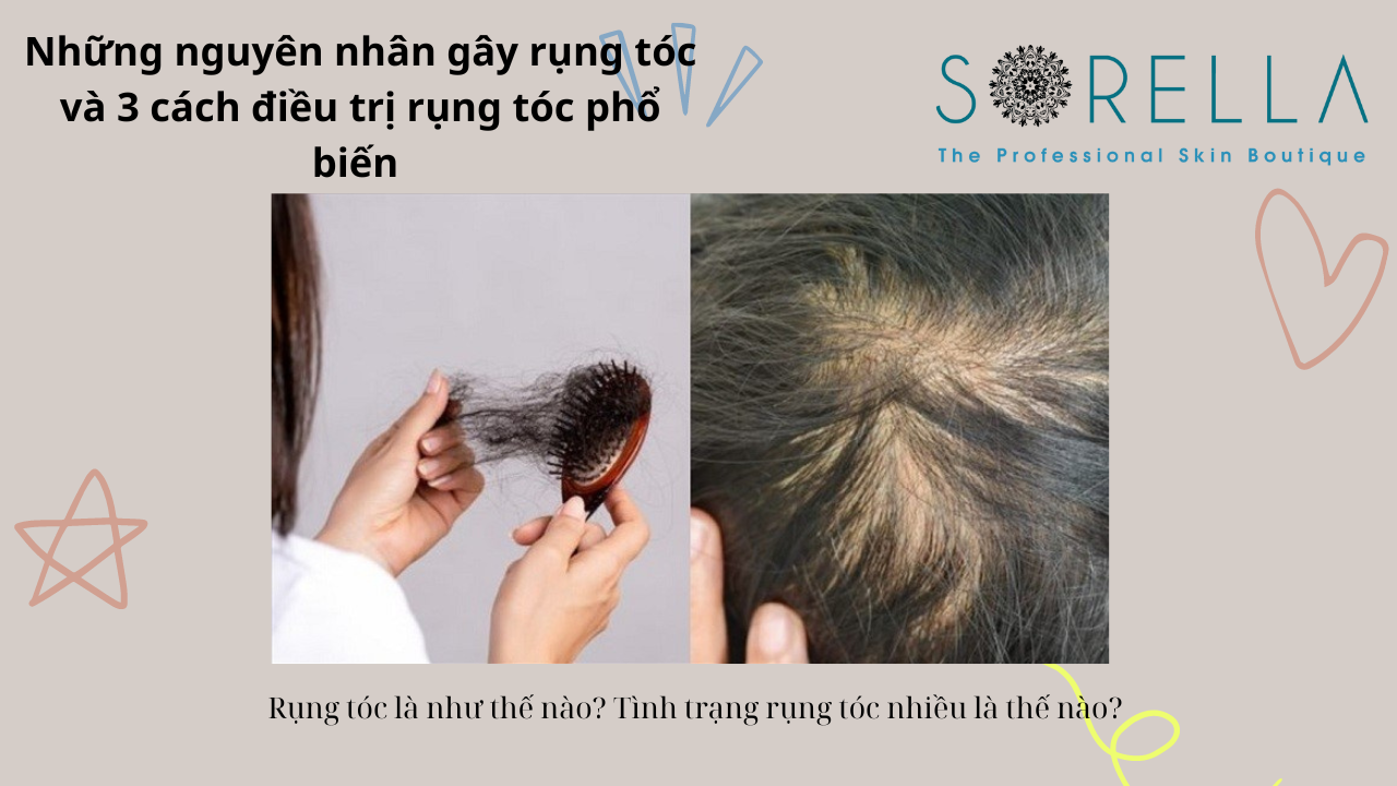 Rụng tóc là như thế nào? 