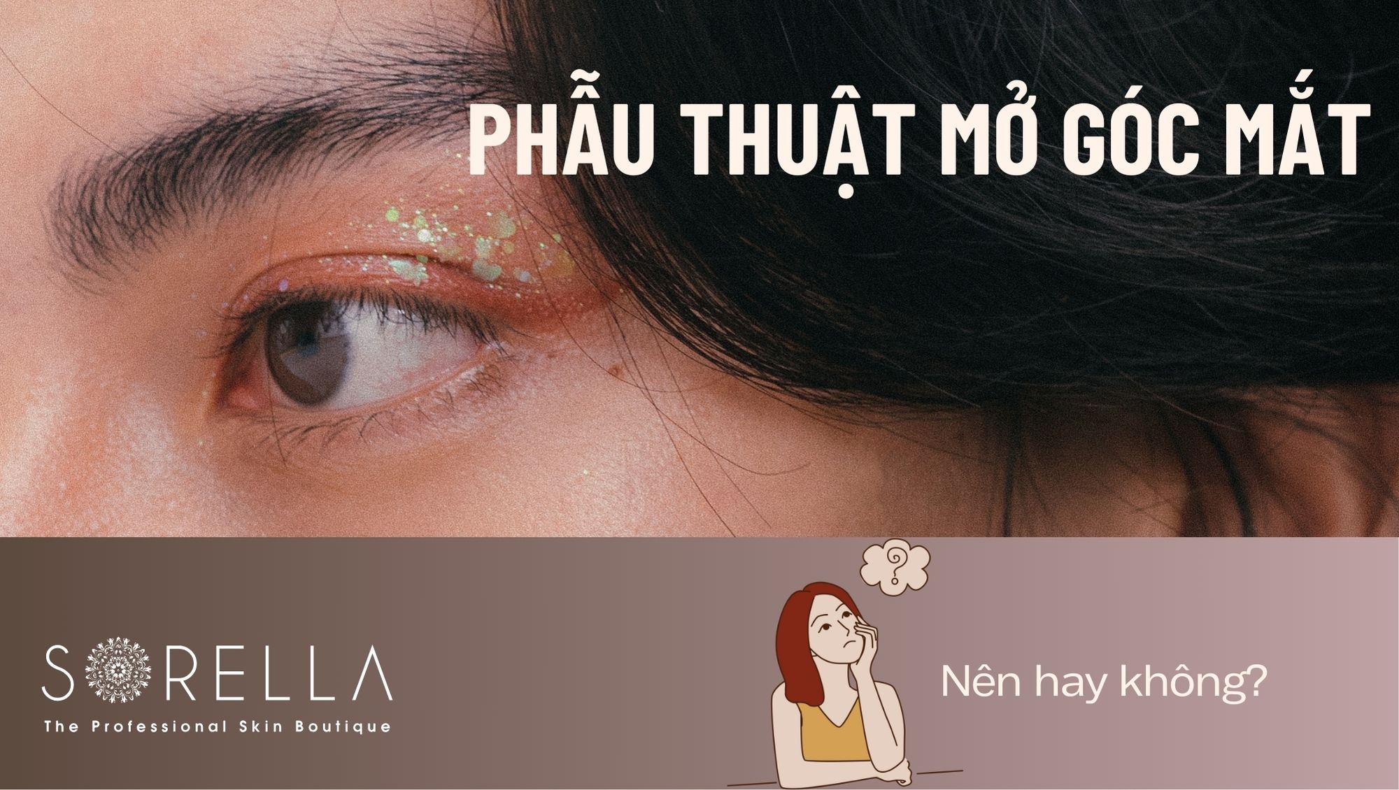 Có nên mở góc mắt không?