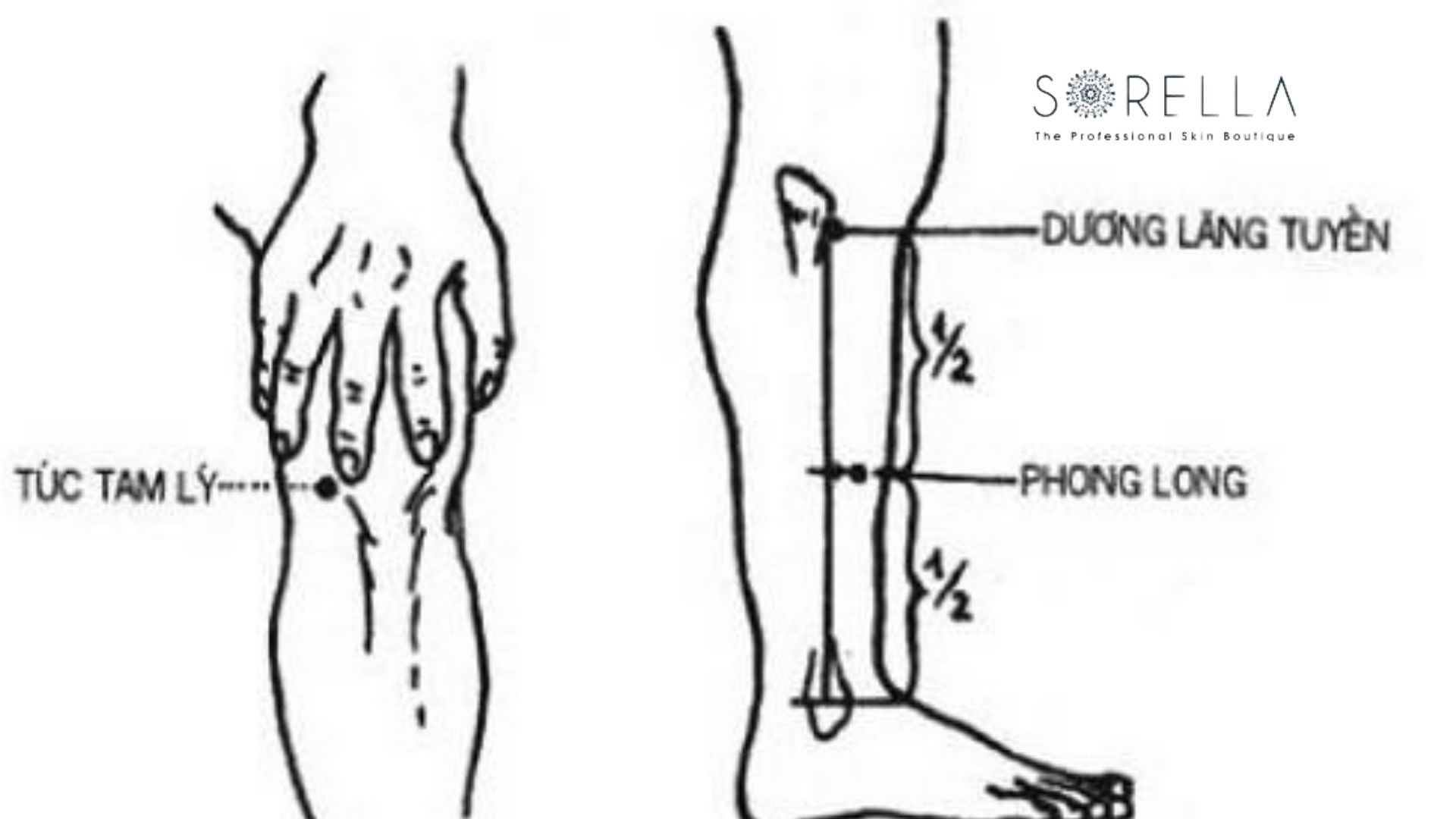 9 huyệt đạo giúp giảm mỡ bụng