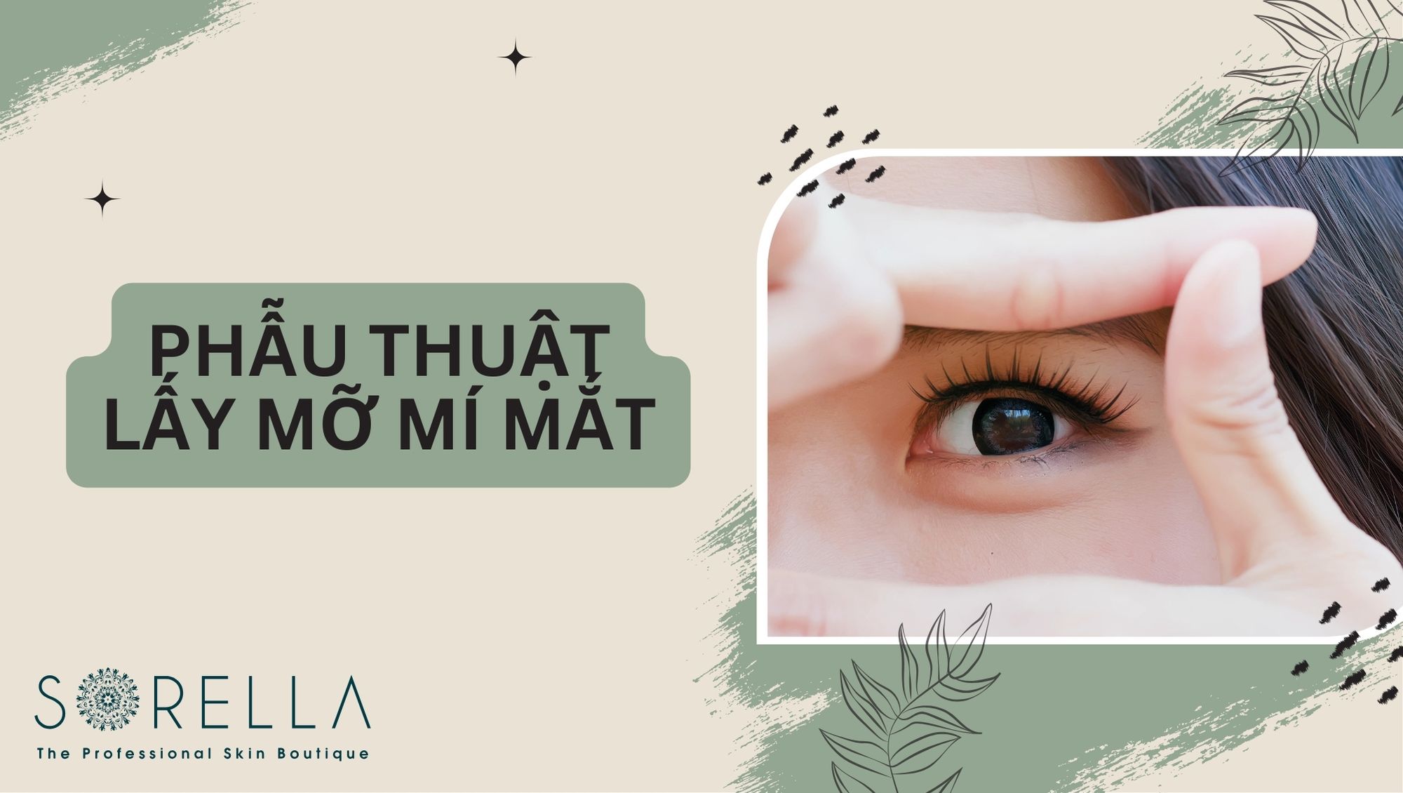 Phẫu thuật lấy mỡ mí mắt trên