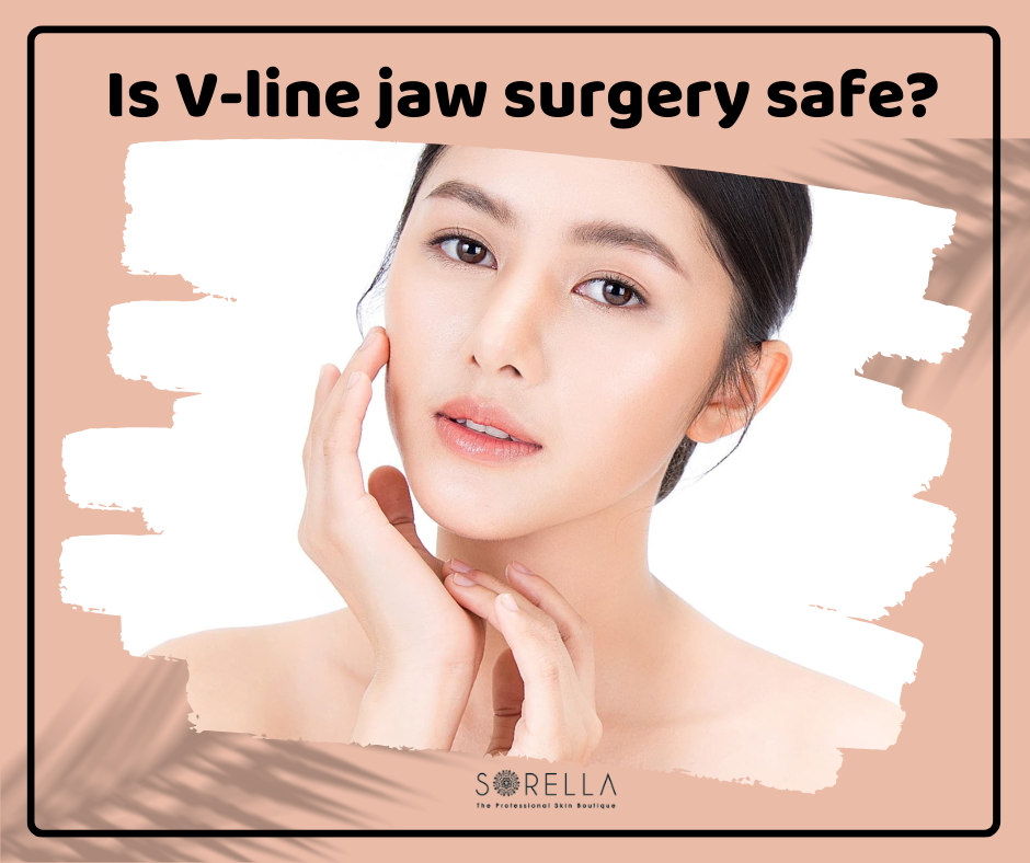 Is V-line jaw surgery safe?